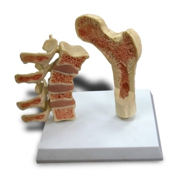JP-501 成人脊椎,股骨骨質疏鬆病態模型